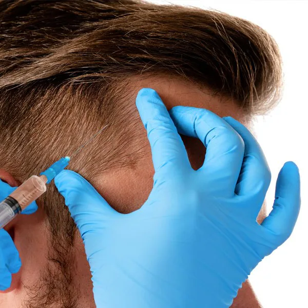 PRF Hair Restoration treatment at MIHSA Aesthetics in New York City