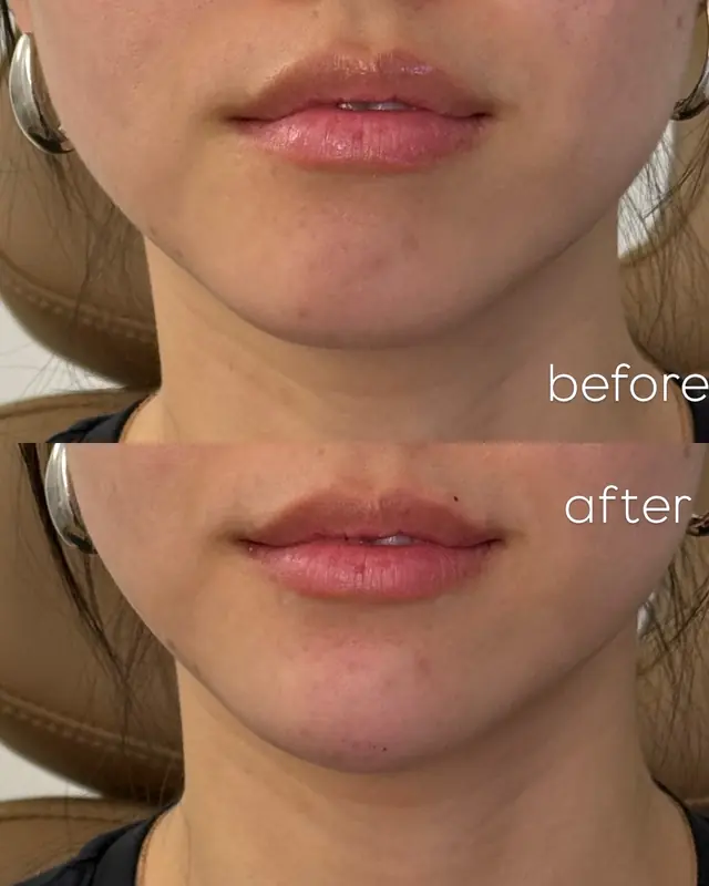 Before and After Result 01 before and after treatment result