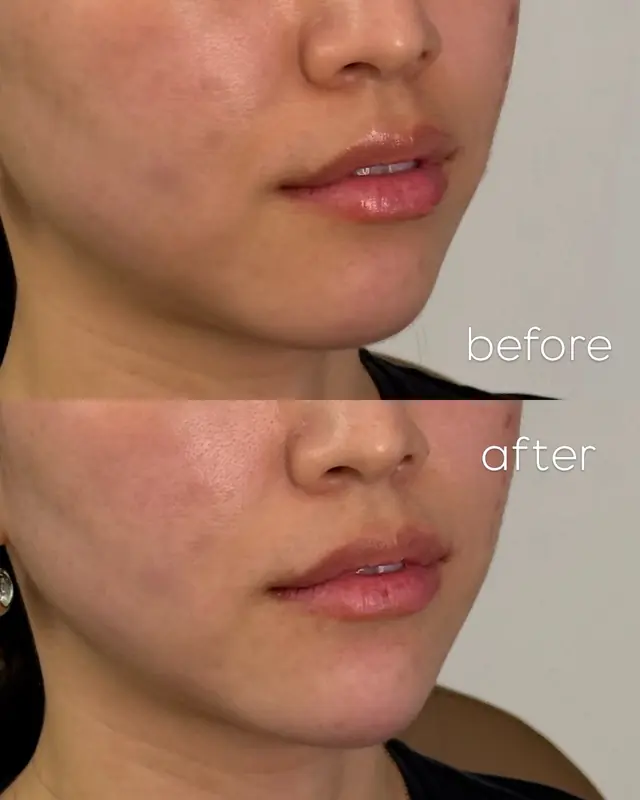 Before and After Result 02 before and after treatment result