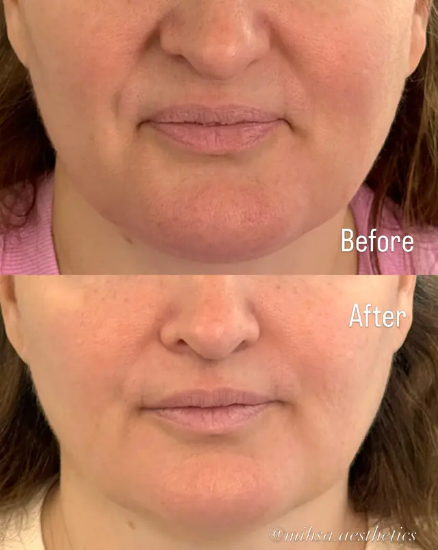 Before and After Result 03 before and after treatment result