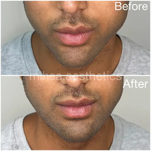Before and After Result 04 before and after treatment result