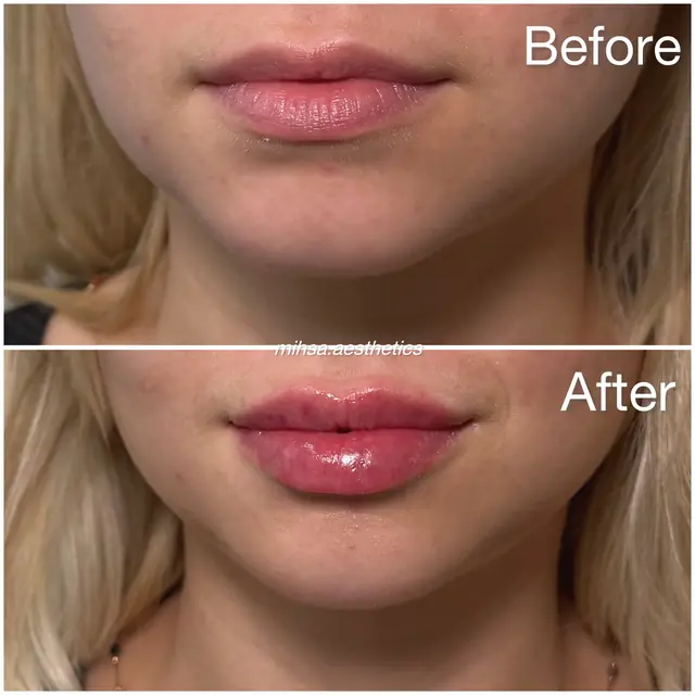 Before and After Result 05 before and after treatment result