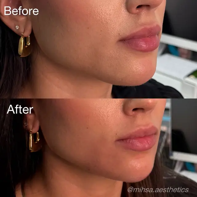 Before and After Result 06 before and after treatment result
