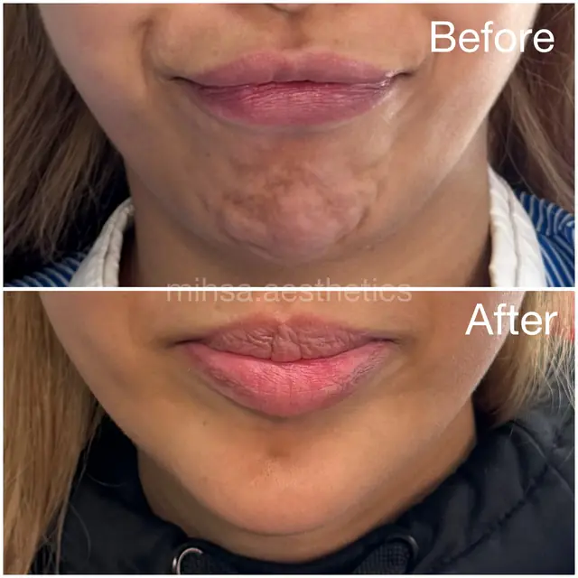 Before and After Result 07 before and after treatment result