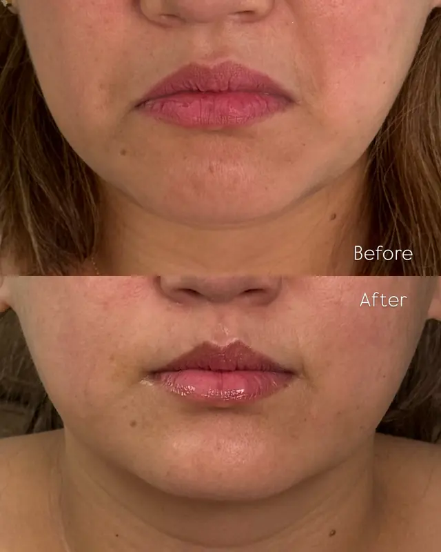 Before and After Result 09 before and after treatment result