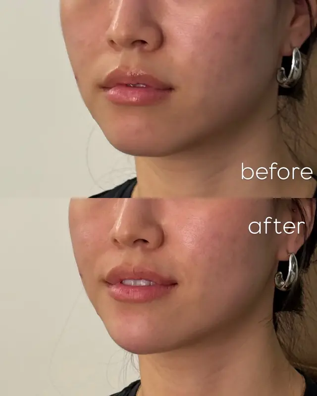 Before and After Result 10 before and after treatment result
