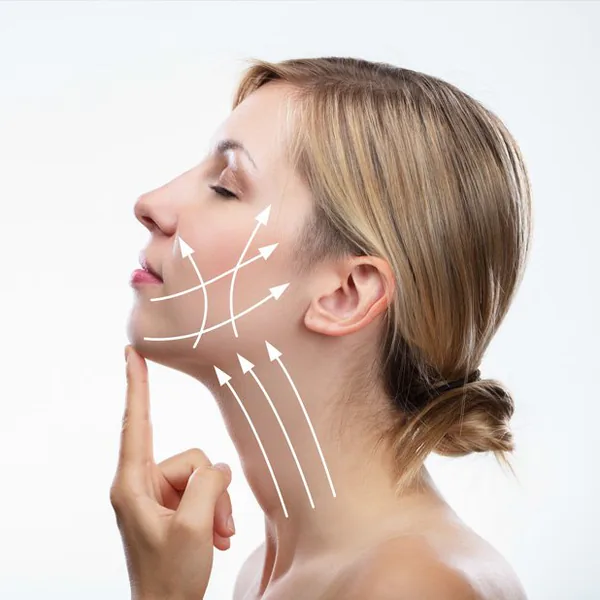 Sculptra treatment at MIHSA Aesthetics in New York City
